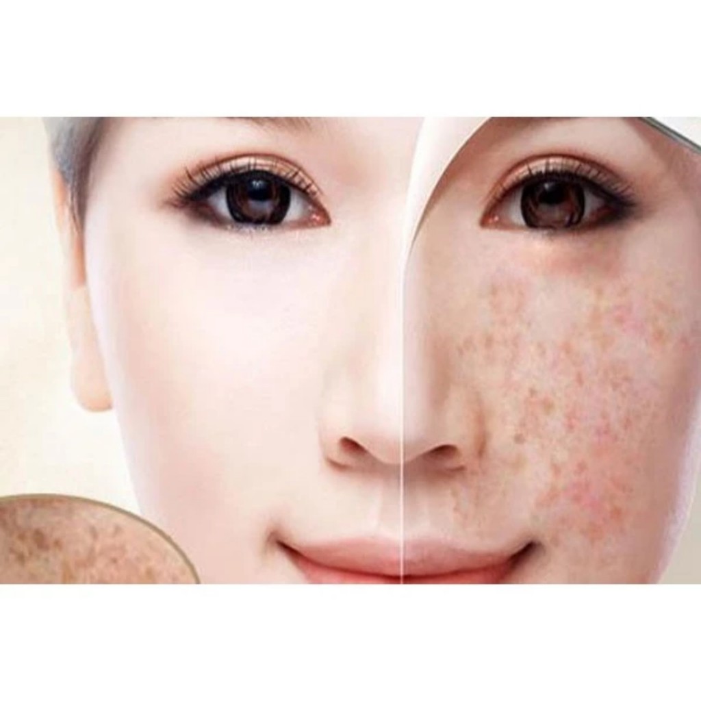 Viên Cao Nám Whoo Radiant White/ Mờ sạm nám, tàn nhang cực hiệu quả, trắng sáng da