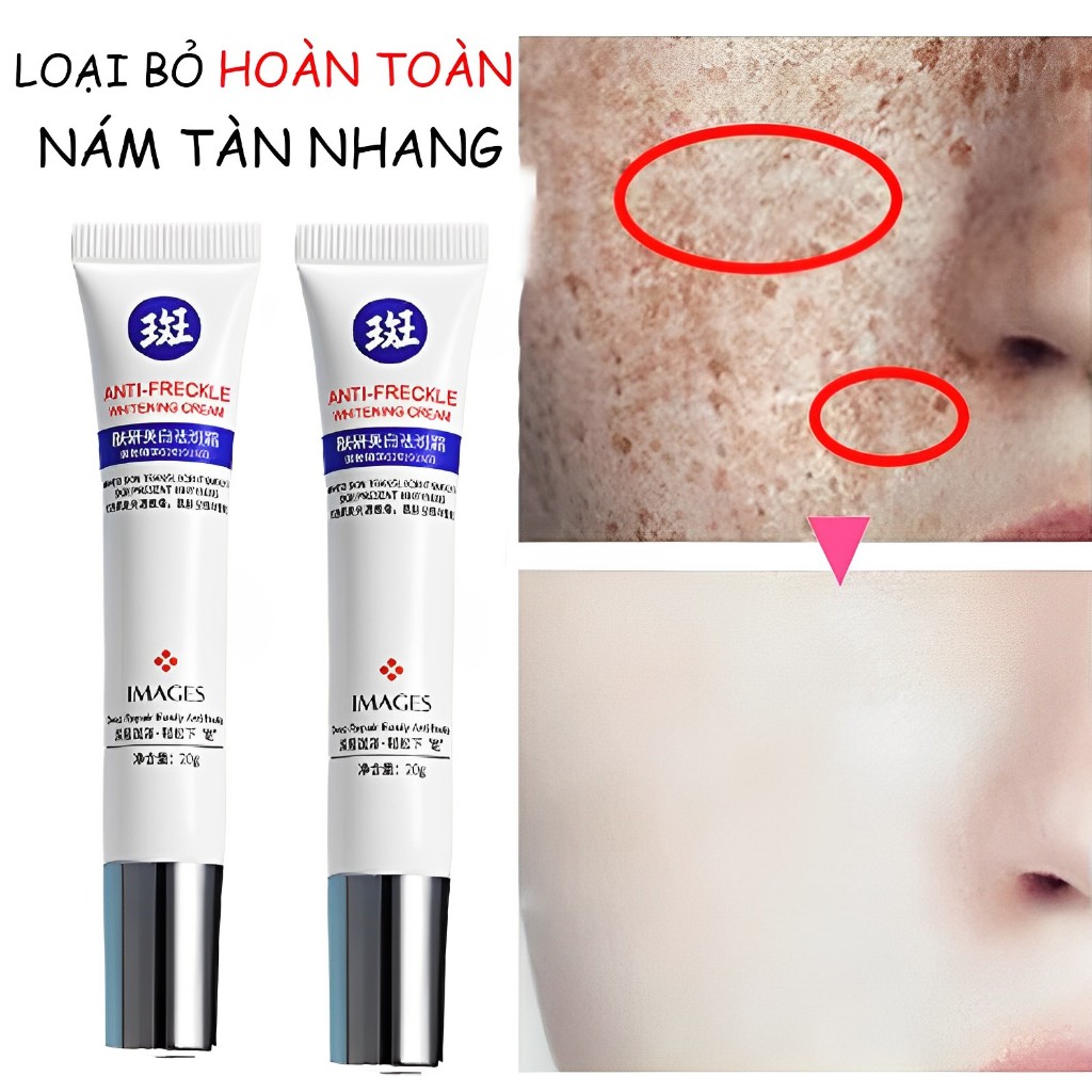 Kem Xóa Tàn Nhang, Dưỡng Trắng Da Mặt IMAGES Anti-Freckle Whitening Cream