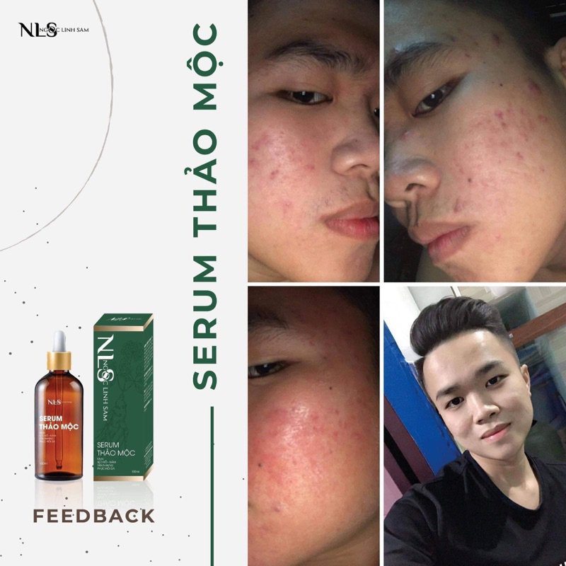 Serum thảo dược tái tạo NGỌC LINH SÂM