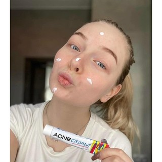 KEM MỤN ACNE DERM 20G - TUÝP