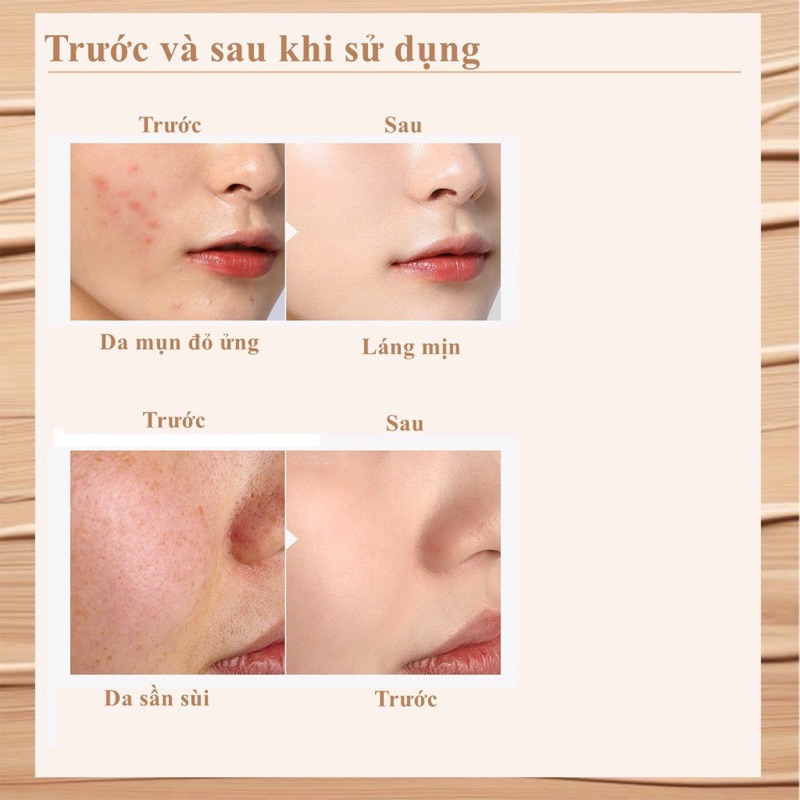 Kem Che Khuyết Điểm 3 Màu BEAUTY GLAZED