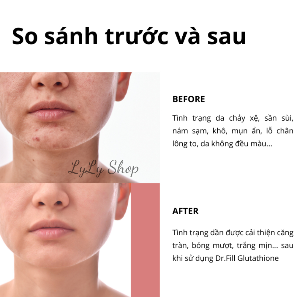 Film Ngậm Trắng Da Glutathione Hàn Quốc, Giúp da trắng sáng, mờ thâm nám từ sâu bên trong Lylyshop 30 miếng