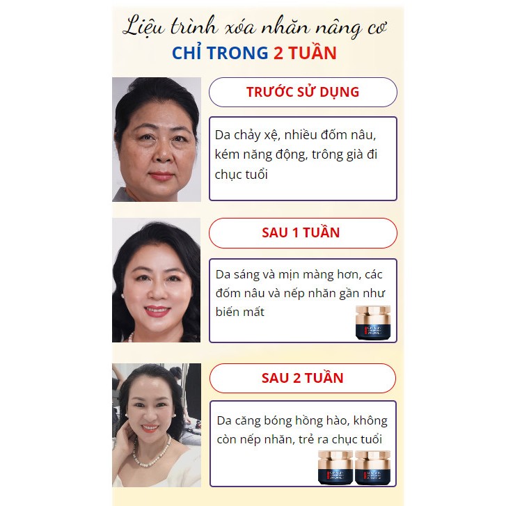 Kem QINGLIN xóa nhăn, nâng cơ, bổ sung Collagen trẻ hóa làn da 50g - Hàng xuất Nhật