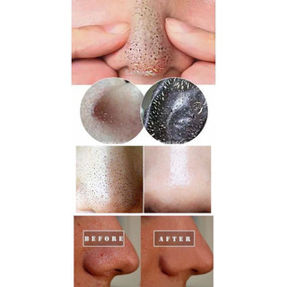 Gel lột mụn đầu đen nofa than tre 75g