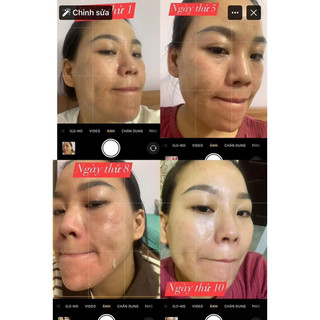(TẶNG 4 NẠ CỪU ) COMBO PEEL DA COLLAGEN GALYLIN