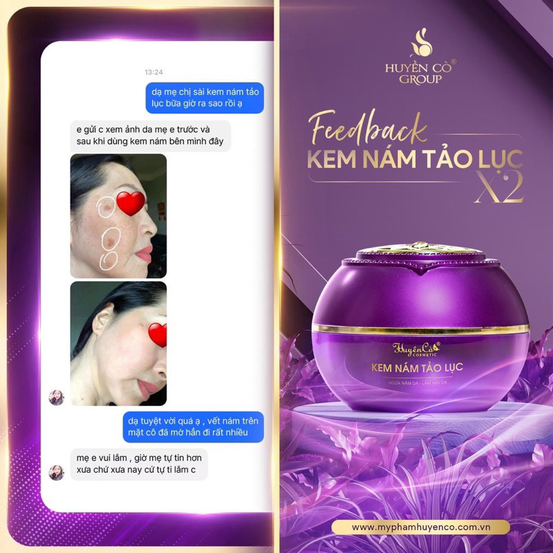 HỘP FACE NÁM HUYỀN CÒ 30 GR CHÍNH HÃNG