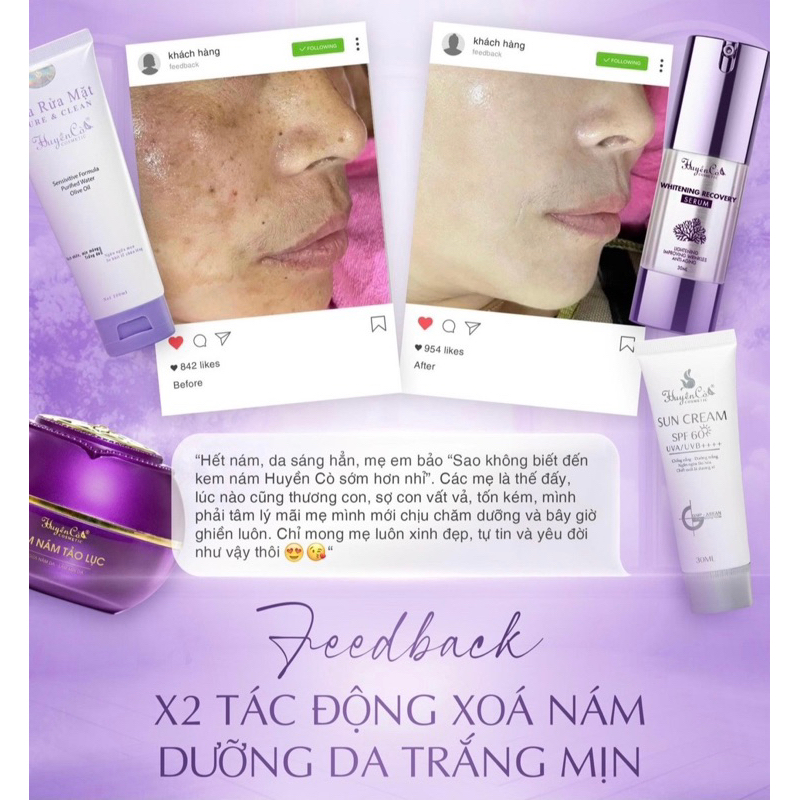 HỘP FACE NÁM HUYỀN CÒ 30 GR CHÍNH HÃNG