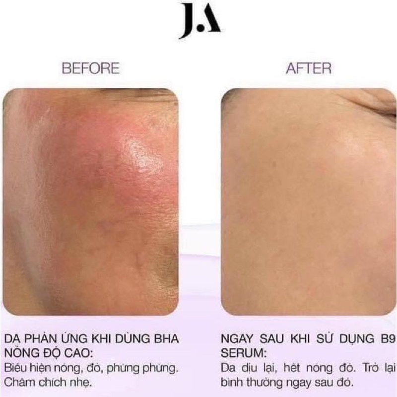 SERUM GIẢM KÍCH ỨNG JULIETTE ARMAND FOLIC ACID B9 20ML