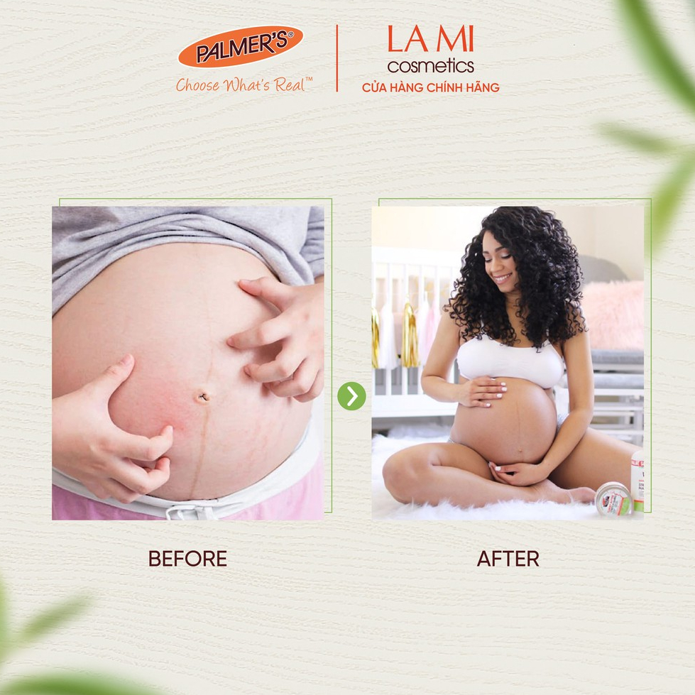 Dầu giảm nhanh khô ngứa da khi mang thai Palmer's 150ml