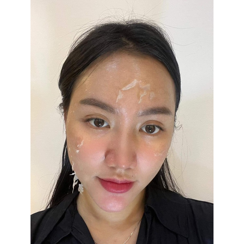 Peel da sinh học sáng da, mờ thâm, tàn nhang, nám MD:Ceuticals - TRANEXAMIC ACID & RETINOL