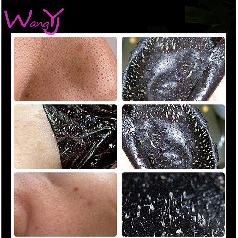 Gel Lột Mụn Đầu Đen Black Head