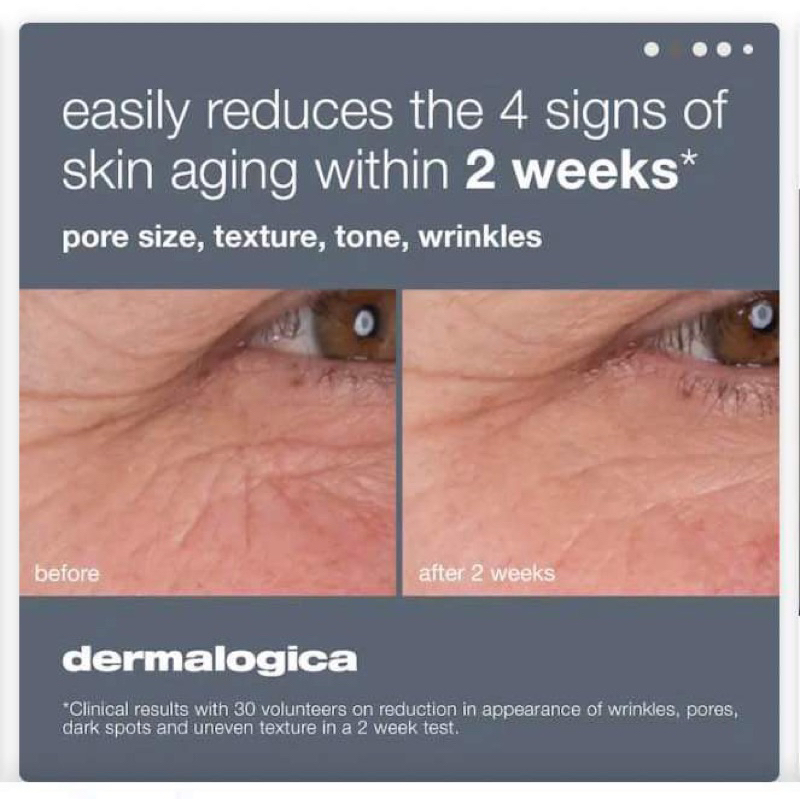 D€rmalogica Dynamic skin retinol serum chống lão hoá