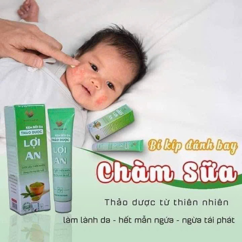 Kem bôi da Lợi An