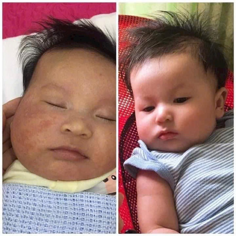 Kem bôi da Lợi An