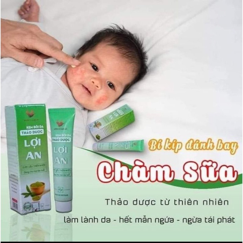 Kem bôi da Lợi An