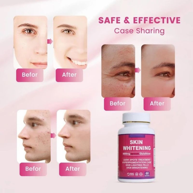 Viên Uống Trắng Da Skin Whitening Glutathione 8000mg - Giảm Nám Tàn Nhang, Da Sáng Bật Tông