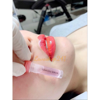 [CHÍNH HÃNG] Tế bào gốc Stem cell