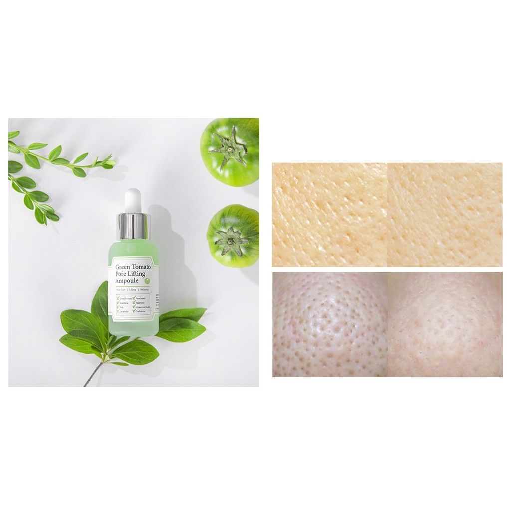 Tinh chất cà chua xanh Sungboon Editor Green Tomato Pore Lifting Ampoule+ 30ml