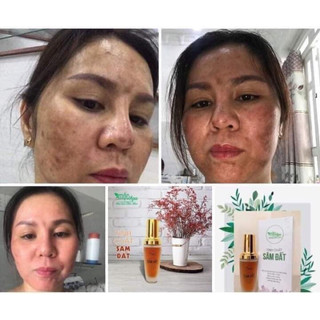Tinh chất sâm đất xả nốt 60%