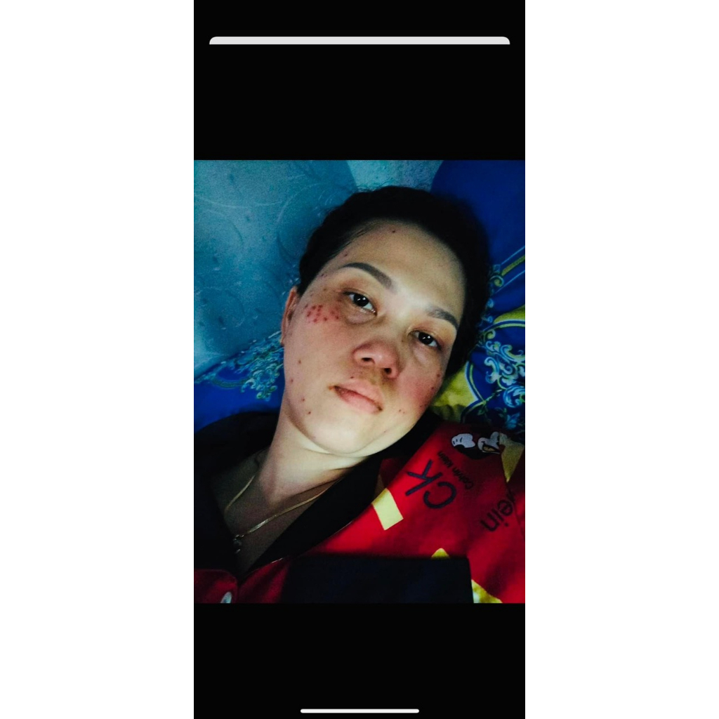 Chấm Xoá Nốt Ruồi, Tàn Nhang Mụn Cóc. Mụn Cơm Mụn Dư Mắc Cá Chân Collagen hũ 3ml