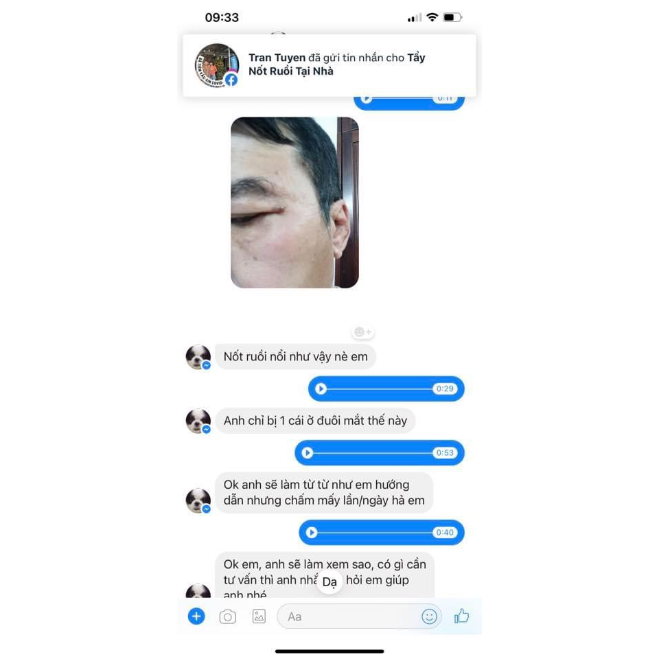 Chấm Xoá Nốt Ruồi, Tàn Nhang Mụn Cóc. Mụn Cơm Mụn Dư Mắc Cá Chân Collagen hũ 3ml