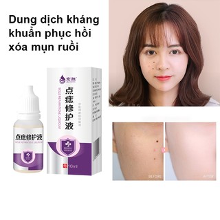 Dung dịch phục hồi xóa nốt ruồi Tẩy mụn ruồi Kem tẩy nốt ruồi 10ml Nhanh chóng xóa bỏ mụn cóc mụn ruồi đen lồi