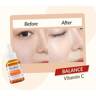 Tinh Chất Làm Sáng Da Balance Vitamin C
