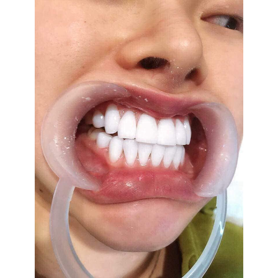 Men làm răng sứ Đức chamsima BXL