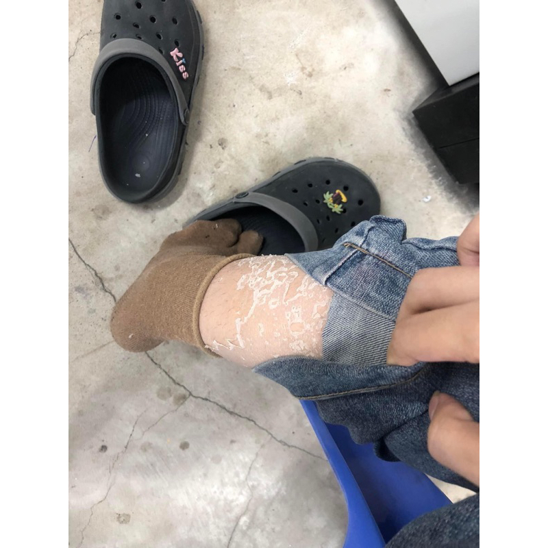 Kem Bong Da NH 150g- Bong Da, Trắng Da Sau 7 ngày