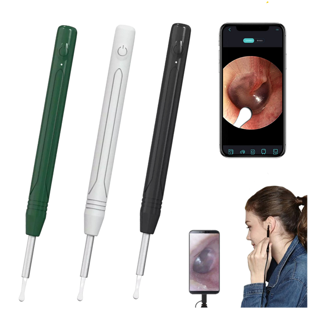 Camera Nội Soi Lấy Ráy Tai KAW Thông Minh Siêu Nét, Kết Nối Wifi, Có Đèn Led Siêu Sáng