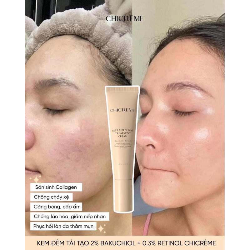 Kem Đêm Dưỡng Da CHICRÈME Ultra-Renewal Treatment Cream 30ml