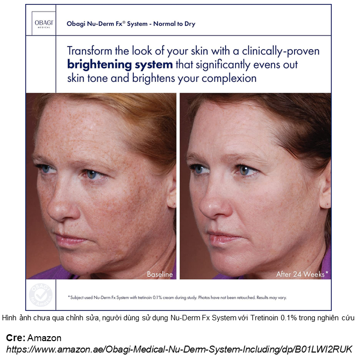 Kem Dưỡng Làm Sáng Da, Giảm Thâm Nám, Đốm Nâu, Chống Lão Hóa - 57g