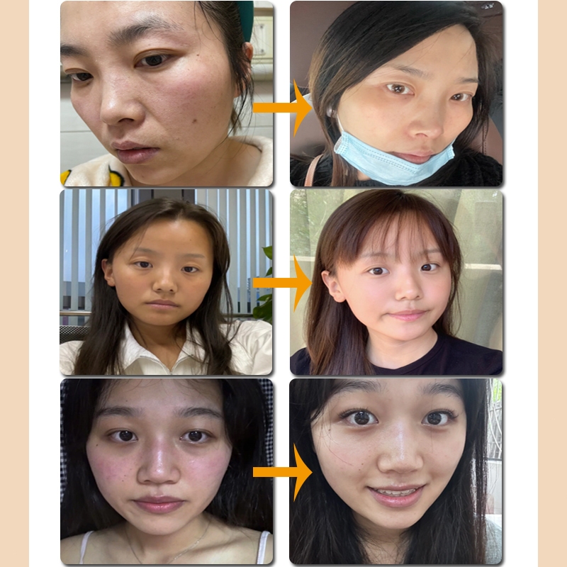 Kem dưỡng ẩm da mặt khô serum dưỡng ẩm da mặt kem dưỡng ẩm da mặt Nó nhanh chóng hydrat hóa, nuôi dưỡng da, làm trắng da