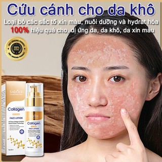 Kem dưỡng ẩm da mặt khô serum dưỡng ẩm da mặt kem dưỡng ẩm da mặt Nó nhanh chóng hydrat hóa, nuôi dưỡng da, làm trắng da