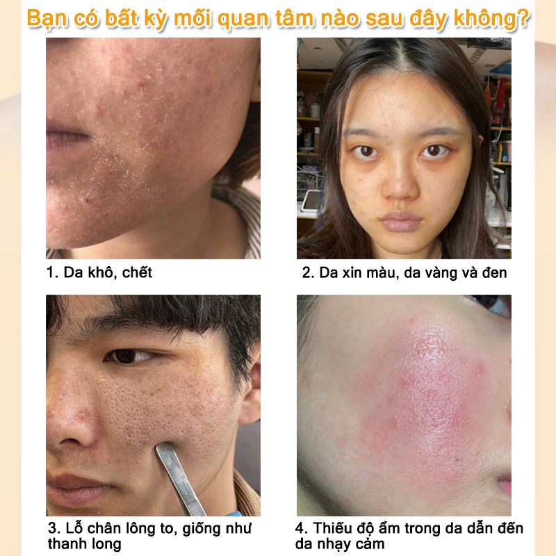 Kem dưỡng ẩm da mặt khô serum dưỡng ẩm da mặt kem dưỡng ẩm da mặt Nó nhanh chóng hydrat hóa, nuôi dưỡng da, làm trắng da