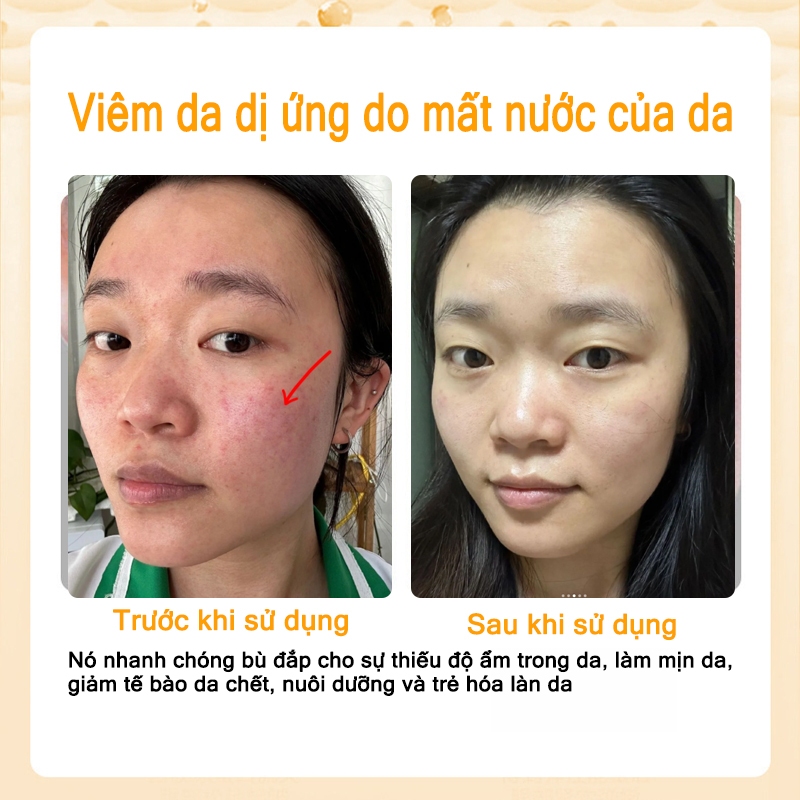 Kem dưỡng ẩm da mặt khô serum dưỡng ẩm da mặt kem dưỡng ẩm da mặt Nó nhanh chóng hydrat hóa, nuôi dưỡng da, làm trắng da