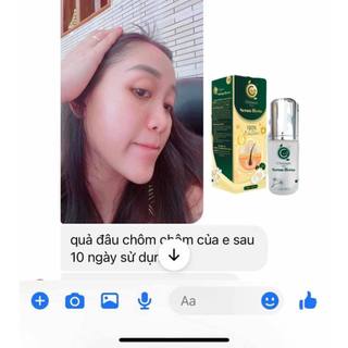 Serum Dưỡng Tóc Herus Nano Chitosan -50ml