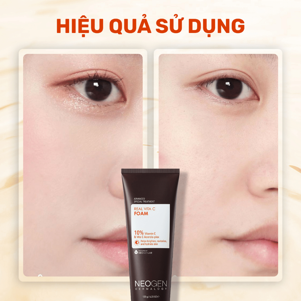 Sữa Rửa Mặt Real Vita C Foam Neogen Dermalogy Làm Sạch Sâu Và Sáng Da – 120g