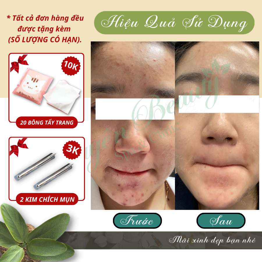 Tinh Chất Peel Tái Tạo Da Mụn Innoaesthetics Skin Recovery 5 lọ × 5ml