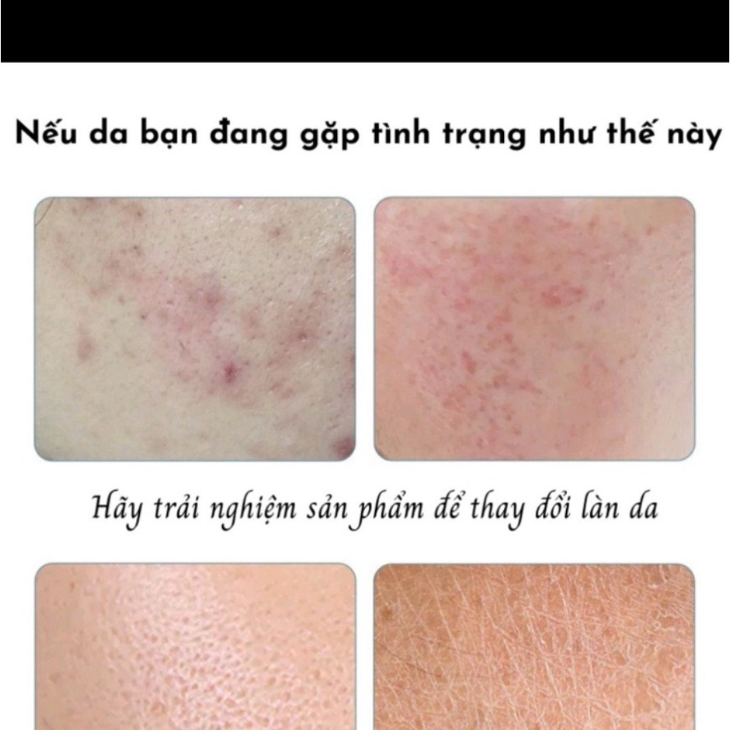 Mặt nạ giấy Bioaqua Hương Trái Cây