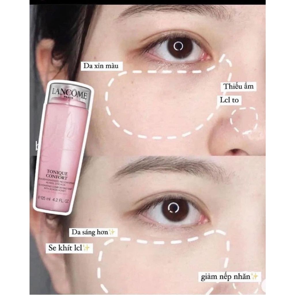 Nước Hoa Hồng Lancome Tonique Confort Cấp Ẩm Toner Cho Da Làm Trắng Da 125ml_ Tín đồ skincare