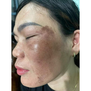 Pell bóc tách đông trùng huyền phi chính hãng
