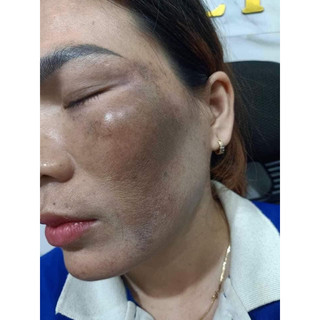 Pell bóc tách đông trùng huyền phi chính hãng