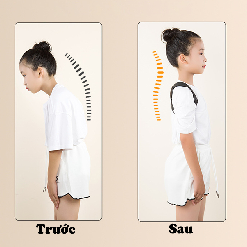 Đai chống gù thông minh JUSUKE cảm biên nhạy cảnh báo khi sai tư thế bảo hành 1 năm