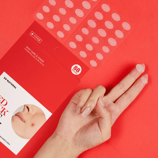 Dán Mụn So'Natural Red Tock - 88 Miếng