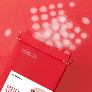 Dán Mụn So'Natural Red Tock - 88 Miếng