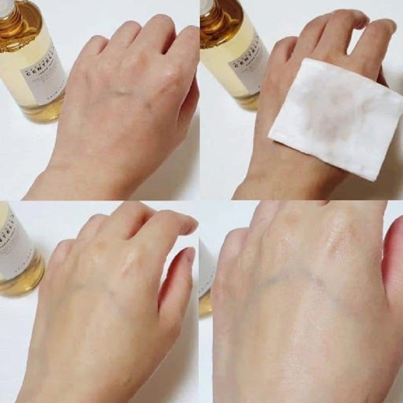 Nước Hoa Hồng Phục Hồi Da Mụn Rau Má Skin1004 - 210ml