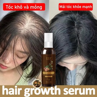 Xịt mọc tóc Serum mọc tóc Tinh chất kích thích mọc tóc giảm rụng tóc nuôi 100ml dưỡng da đầu kích mọc tóc nhanh thảo