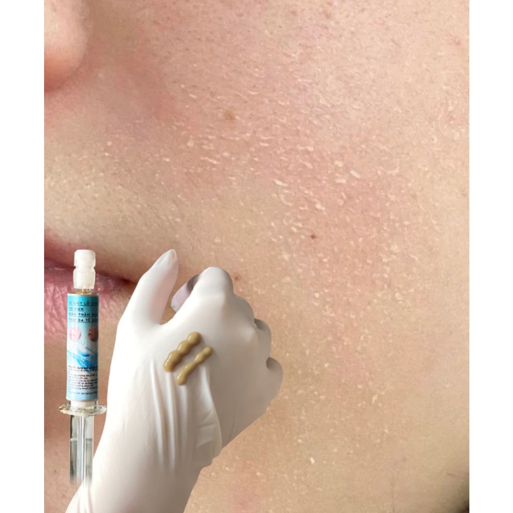 Vi Tảo Rải Sợi Peel Da