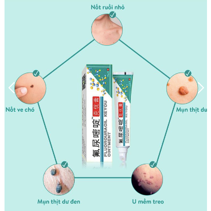 Kem rụng mụn thịt dư KEYOU - KEYOU kem bôi bật gốc cồi mụn thịt dư, nốt ve chó, u mềm treo 20g